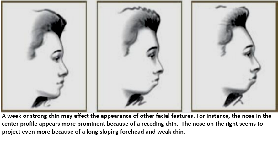 chin-surgery